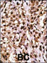 Anti-ATG4A Rabbit Polyclonal Antibody