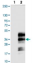 Anti-C19ORF18 Rabbit Polyclonal Antibody