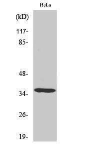 Western blot analysis of various cells using Anti-CKI-alpha Antibody