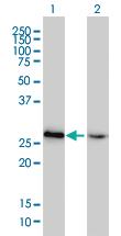 Anti-HMGB2 Mouse Monoclonal Antibody [clone: 4G7]