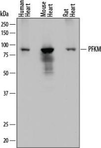 Anti-PFKM Mouse Monoclonal Antibody [clone: 842735]