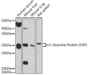 Western blot analysis of extracts of various cell lines, using Anti-C Reactive Protein Antibody (A11127) at 1:1,000 dilution