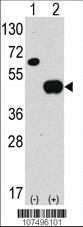 Anti-ATG4B Rabbit Polyclonal Antibody