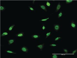 Anti-SNAPC4 Mouse Monoclonal Antibody [clone: 1D1]