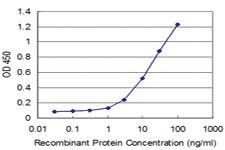 Anti-IRAK4 Mouse Monoclonal Antibody [clone: 3C5]