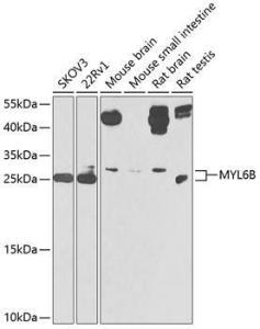 Western blot analysis of extracts of various cell lines, using Anti-mlC1SA Antibody (A307629) at 1:1000 dilution