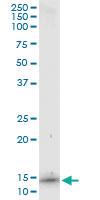 Anti-S100 A7 Mouse Monoclonal Antibody [clone: 3E11]