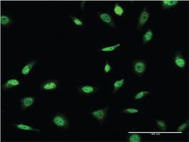 Anti-SNAPC4 Mouse Monoclonal Antibody [clone: 1D1]