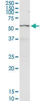 Anti-CHEK2 Rabbit Polyclonal Antibody