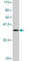 Anti-ACP1 Mouse Monoclonal Antibody [clone: 2A3]