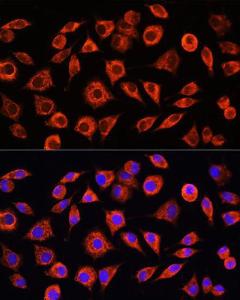 Immunofluorescence analysis of L929 cells using Anti-C Reactive Protein Antibody (A11127) at a dilution of 1:100. DAPI was used to stain the cell nuclei (blue)