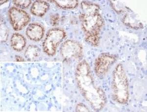 Immunohistochemical analysis of formalin-fixed, paraffin-embedded human kidney tissue using Anti-RBP4 Antibody [rRBP4/7372] Inset: PBS instead of the primary antibody Secondary antibody negative control