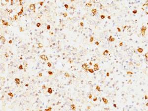 Immunohistochemical analysis of formalin-fixed, paraffin-embedded human pituitary using Anti-FSH beta Antibody [FSHb/1062]