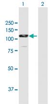 Anti-CTNNA2 Rabbit Polyclonal Antibody