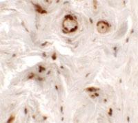 Anti-UPK1B Rabbit Polyclonal Antibody