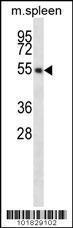 Anti-S1PR4 Rabbit Polyclonal Antibody (FITC (Fluorescein Isothiocyanate))