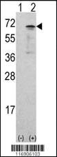 Anti-MAP2K7 Rabbit Polyclonal Antibody