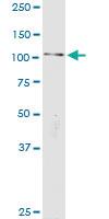 Anti-CTNNA2 Rabbit Polyclonal Antibody