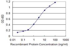 Anti-SNAPC4 Mouse Monoclonal Antibody [clone: 1G2]