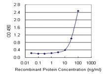 Anti-IL6R Mouse Monoclonal Antibody (Biotin)