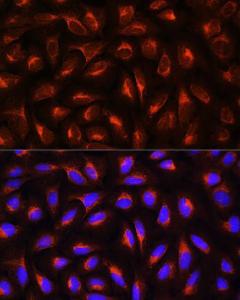 Immunofluorescence analysis of U2OS cells using Anti-C Reactive Protein Antibody (A11127) at a dilution of 1:100. DAPI was used to stain the cell nuclei (blue)