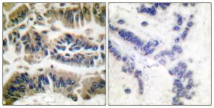 Anti-Caspase 6 antibody