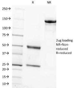 SDS-PAGE analysis of Anti-FSH beta Antibody [FSHb/1062] under non-reduced and reduced conditions; showing intact IgG and intact heavy and light chains, respectively. SDS-PAGE analysis confirms the integrity and purity of the antibody