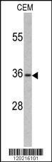 Anti-PAX4 Rabbit Polyclonal Antibody