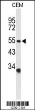 Anti-ASIC1 Rabbit Polyclonal Antibody (AP (Alkaline Phosphatase))