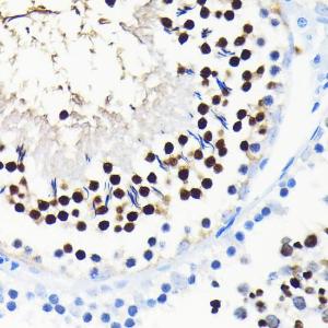 Immunohistochemistry analysis of paraffin-embedded rat testis using Anti-TCF-4 / TCF7L2 Antibody [ARC0027] (A307630) at a dilution of 1:100 (40x lens). Perform microwave antigen retrieval with 10 mM PBS buffer pH 7.2 before commencing with IHC staining protocol.