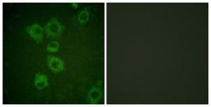 Anti-Caspase 6 antibody