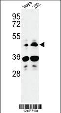 Anti-HS3ST2 Rabbit Polyclonal Antibody