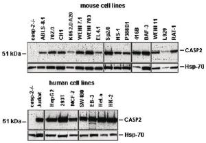 Anti-CASP2 Rat Monoclonal Antibody [clone: 11B4]