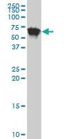 Anti-TGFBI Mouse Polyclonal Antibody