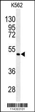 Anti-ANGPTL6 Rabbit Polyclonal Antibody