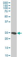 Anti-HMGB2 Mouse Monoclonal Antibody [clone: 3C7]