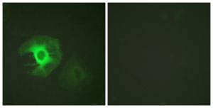 Antibody anti-caldesmon A94777-100 100 µg