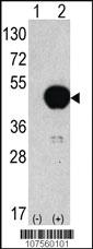 Anti-ATG4B Rabbit Polyclonal Antibody