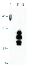 Anti-HBEGF Mouse Monoclonal Antibody [clone: 4G10]