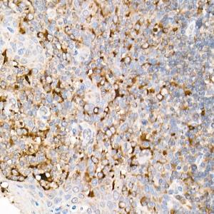 Anti-Fas Ligand Rabbit Polyclonal Antibody