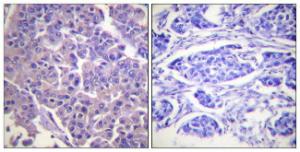 Antibody anti-caldesmon A94777-100 100 µg