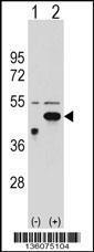 Anti-ETNK2 Rabbit Polyclonal Antibody (AP (Alkaline Phosphatase))