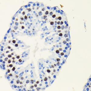 Immunohistochemistry analysis of paraffin-embedded mouse testis using Anti-TCF-4 / TCF7L2 Antibody [ARC0027] (A307630) at a dilution of 1:100 (40x lens). Perform microwave antigen retrieval with 10 mM PBS buffer pH 7.2 before commencing with IHC staining protocol.