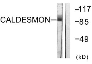 Antibody anti-caldesmon A94777-100 100 µg