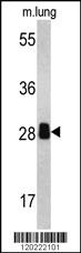 Anti-PSME2 Rabbit Polyclonal Antibody