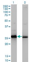 Anti-HMGB2 Mouse Monoclonal Antibody [clone: 3C7]