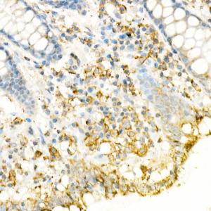 Anti-Fas Ligand Rabbit Polyclonal Antibody