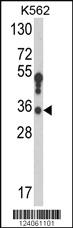 Anti-HSD17B3 Rabbit Polyclonal Antibody