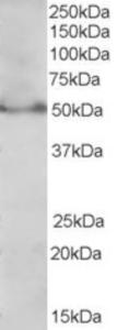 EB06474 0.3x µg/ml) staining of MOLT4 lysate (35 µg protein in RIPA buffer). Primary incubation was 1 hour. Detected by chemiluminescence.