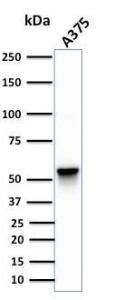 Western blot analysis of human A375 cell lysate using Anti-Vimentin Antibody [SPM576]